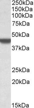 UBASH3A Antibody