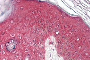 HCRTR2 Antibody