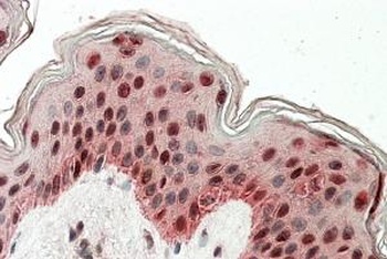 ARHGDIG Antibody