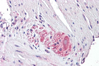 PLN Antibody