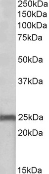 ETFB Antibody