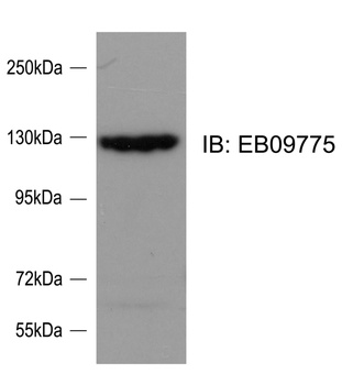 FANCE Antibody