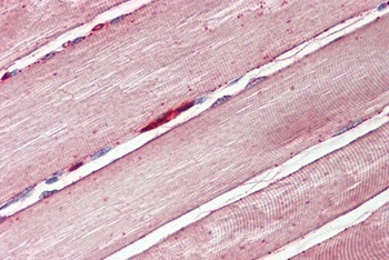 CST8 Antibody