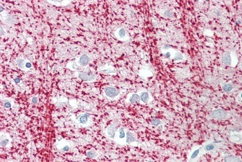 TPPP Antibody