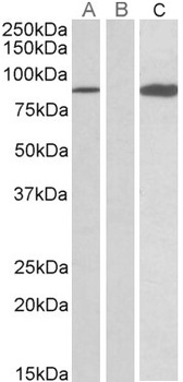 NDUFS6 Antibody