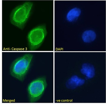 CMA1 Antibody