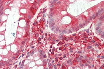 RPS6KA2 Antibody