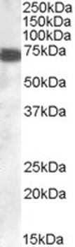 ZDHHC13 Antibody