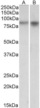 NOX5 Antibody