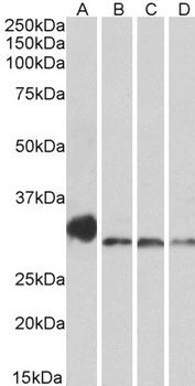 SYT2 Antibody