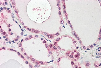 TH1L Antibody