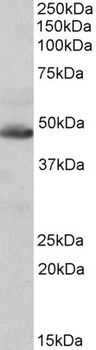 TMEM205 Antibody