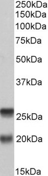 TMEM205 Antibody
