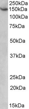 PTCHD1 Antibody