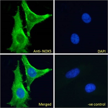 ALDH6A1 Antibody