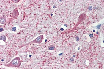 ALDH5A1 Antibody