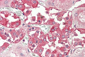 HLA-DQA2 Antibody