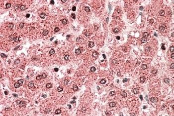 HLA-DQA2 Antibody