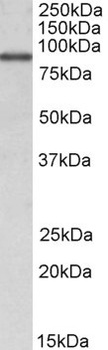 RHCG Antibody