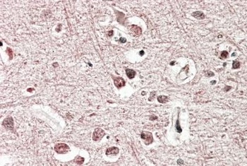 POR Antibody