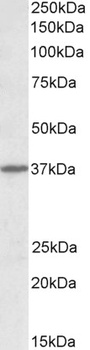 MOGAT2 Antibody