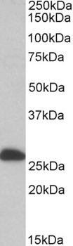 ALDH9A1 Antibody