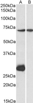 IL12RB1 Antibody
