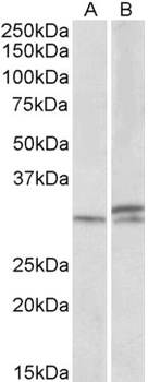 IGF2BP1 Antibody
