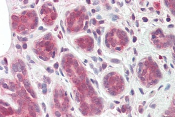 HOXA9 Antibody