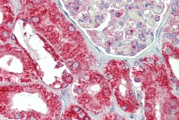 CLCN2 Antibody