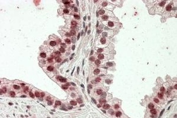 FBXO4 Antibody