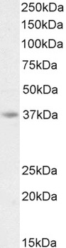 AIM2 Antibody