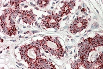 GLUD1 / GLUD2 Antibody