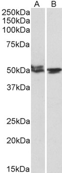 DYDC1 Antibody