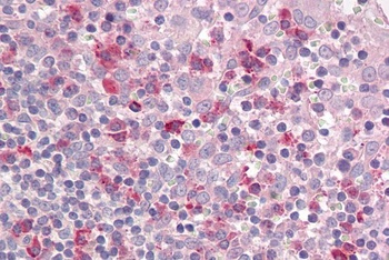 RSL1D1 Antibody