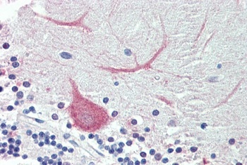 KCNE3 Antibody