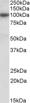 Gsta5 Antibody