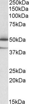 EPM2AIP1 Antibody