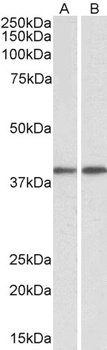 SDF4 Antibody