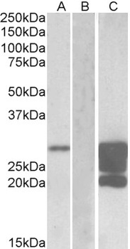 PKP2 Antibody
