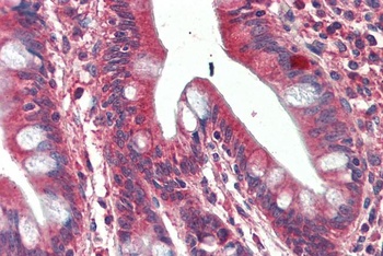Crot Antibody