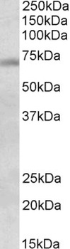 TFB2M Antibody