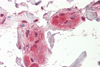 C22orf28 Antibody