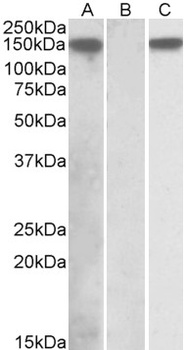 IDH3A Antibody