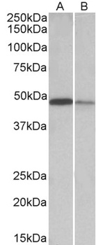 GNB2L1 Antibody