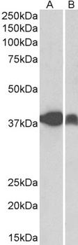 PAPD5 Antibody