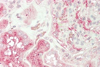 ZIC2 Antibody