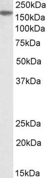 TGFBI Antibody