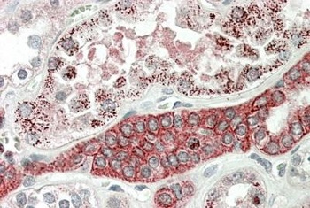 SEC23A Antibody