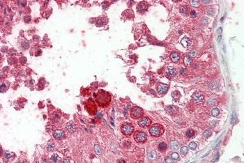 PLA2R1 Antibody